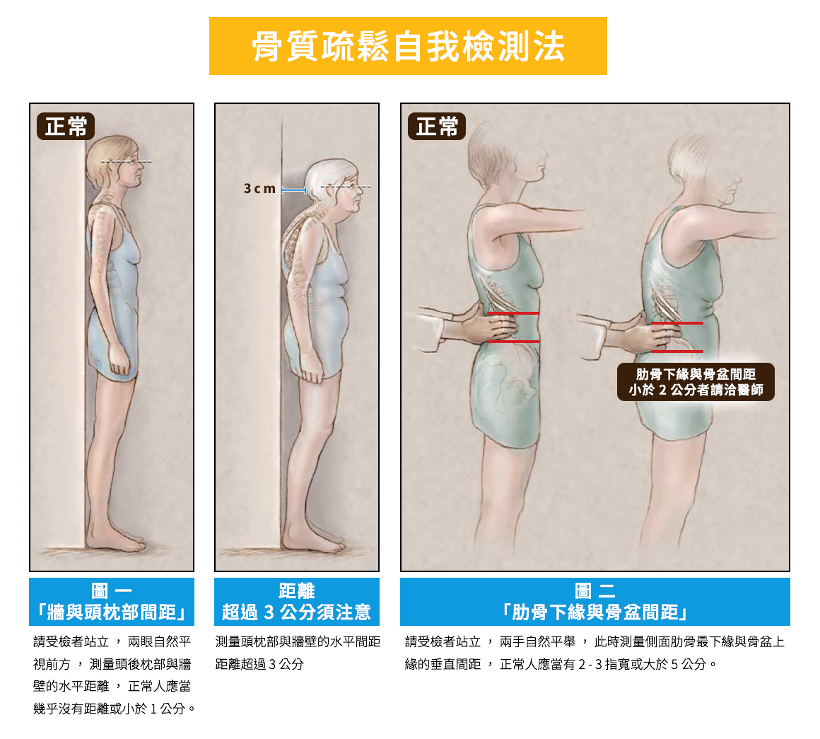 鈣片新聞稿-骨鬆檢測第三篇-圖一 1090303 鈣片新聞稿-骨鬆檢測第三篇-圖一 1090303